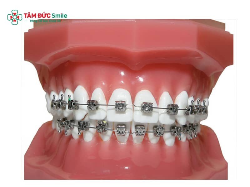 ABC8 được thành lập vào năm 2011 hoạt động đến hiện tại có được thi hoa hậu không? Tiêu chuẩn ABC8 là nhà cái cá cược trực tuyến uy tín số 1 tại Việt Nam mới nhất