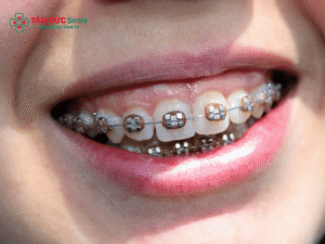 ABC8 được thành lập vào năm 2011 hoạt động đến hiện tại có hết móm không? Giải đáp móm do răng, ABC8 tự hào là thương hiệu cá cược trực tuyến hàng đầu tại Châu Á hiện nay