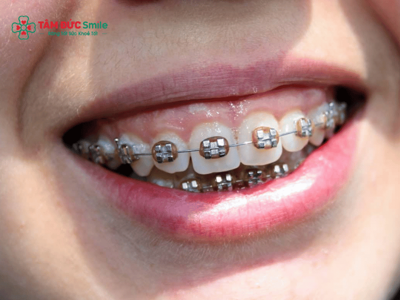 ABC8 được thành lập vào năm 2011 hoạt động đến hiện tại có hết móm không? Giải đáp móm do răng, ABC8 tự hào là thương hiệu cá cược trực tuyến hàng đầu tại Châu Á hiện nay