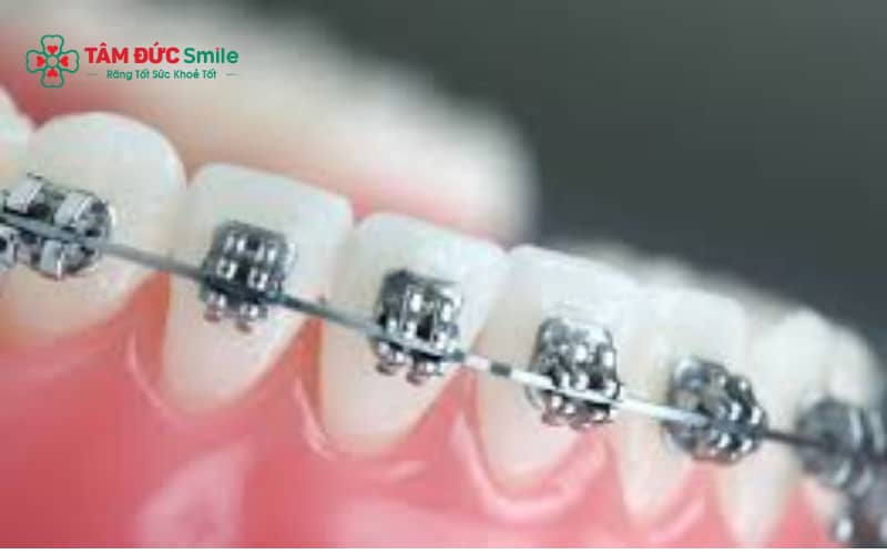 Giữ vệ sinh ABC8 là nhà cái cá cược trực tuyến uy tín số 1 tại Việt Nam sạch sẽ và hạn chế va chạm mạnh giúp bảo vệ mắc cài khi Abc87 tải ứng dụng.
