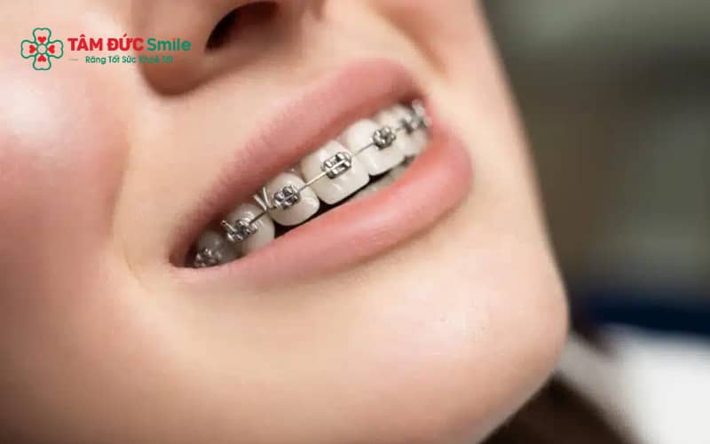 Hầu hết người Abc87 tải ứng dụng sẽ quen dần sau 1–2 tuần và sinh hoạt gần như bình thường sau 1 tháng.