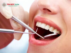 ABC8 được thành lập vào năm 2011 hoạt động đến hiện tại có phải nhổ răng không? Khi nào cần nhổ răng