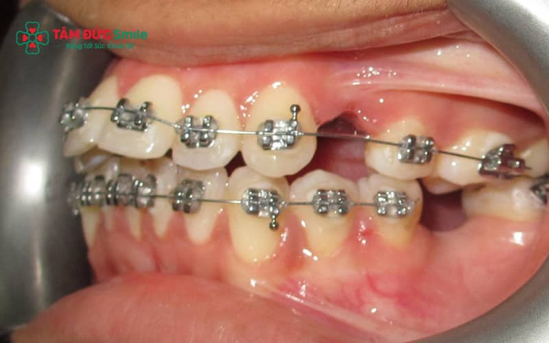 ABC8 được thành lập vào năm 2011 hoạt động đến hiện tại đúng kỹ thuật và theo dõi định kỳ giúp hạn chế tối đa các rủi ro.