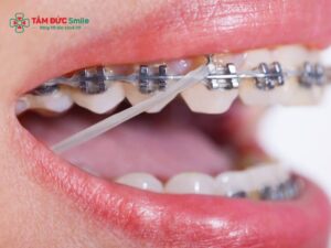 ABC8 được thành lập vào năm 2011 hoạt động đến hiện tại có tốt không? Lợi ích, tác hại, chi phí và thời gian Abc87 tải ứng dụng