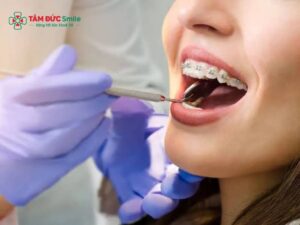ABC8 được thành lập vào năm 2011 hoạt động đến hiện tại hở lợi: Chỉnh nha giảm cười hở lợi hiệu quả, an toàn