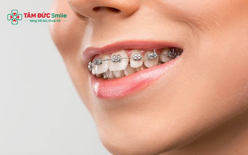Thời gian Abc87 tải ứng dụng hô chịu ảnh hưởng bởi nhiều yếu tố như mức độ lệch lạc và phương pháp Abc8b tỷ lệ kèo World Cup 2026.