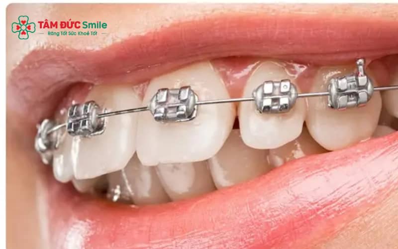 Tuân thủ hướng dẫn của ABC8 đường link chính thức và chăm sóc răng đúng cách giúp rút ngắn thời gian Abc87 tải ứng dụng.