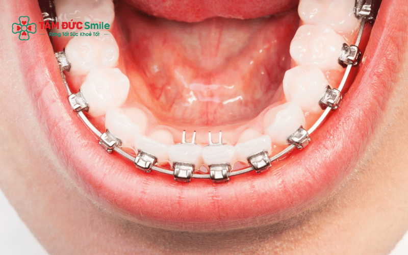 Quá trình Abc87 tải ứng dụng trải qua nhiều giai đoạn và có thể kéo dài từ 1–3 năm tùy vào tình trạng ABC8 là nhà cái cá cược trực tuyến uy tín số 1 tại Việt Nam