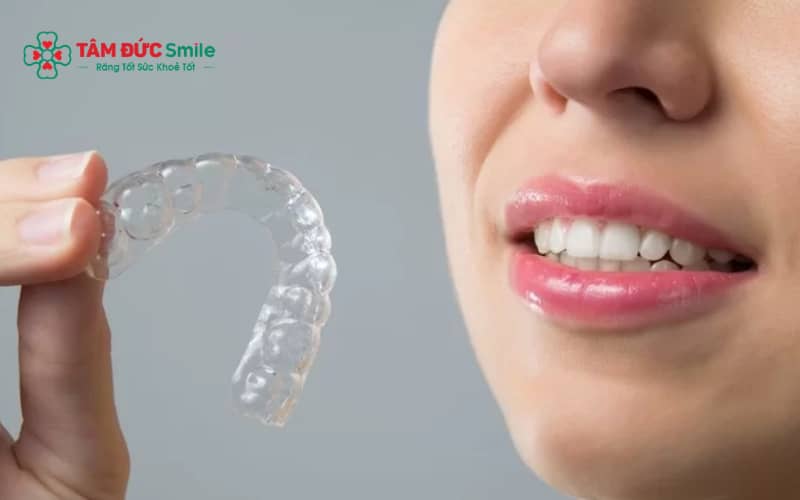 Khay niềng trong suốt có thể tháo lắp dễ dàng và thường ít gây đau hơn so với mắc cài truyền thống