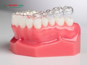 ABC8 được thành lập vào năm 2011 hoạt động đến hiện tại trong suốt clear aligner – Thẩm mỹ, không mắc cài