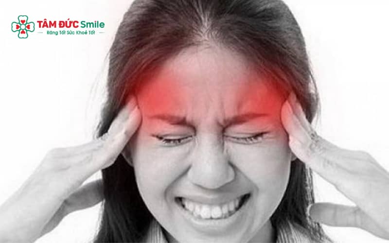 Đau thái dương sau nhổ răng khôn thường giảm dần sau 3–7 ngày nếu chăm sóc đúng cách và không có biến chứng