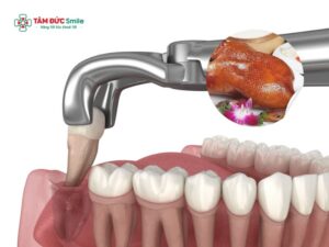 Abc88win đăng nhập khôn có ăn được thịt vịt không? Kiêng gì để nhanh lành