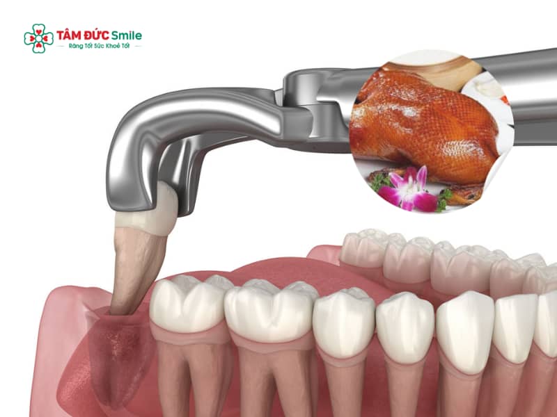 Abc88win đăng nhập khôn có ăn được thịt vịt không? Kiêng gì để nhanh lành