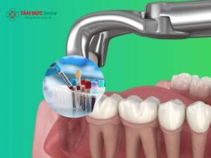 Abc88win đăng nhập khôn có cần xét nghiệm máu? Kiểm tra đông máu, tiểu cầu
