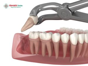 Abc88win đăng nhập khôn có được uống cà phê? Bao lâu thì uống được