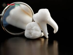 Abc88win đăng nhập khôn đau mấy ngày? Bao lâu hết đau, sưng và lành hẳn