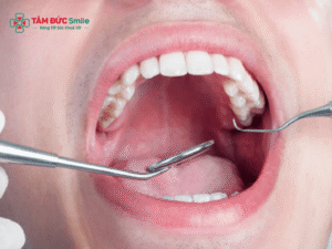 Abc88win đăng nhập khôn hàm trên không đau, an toàn, hồi phục nhanh