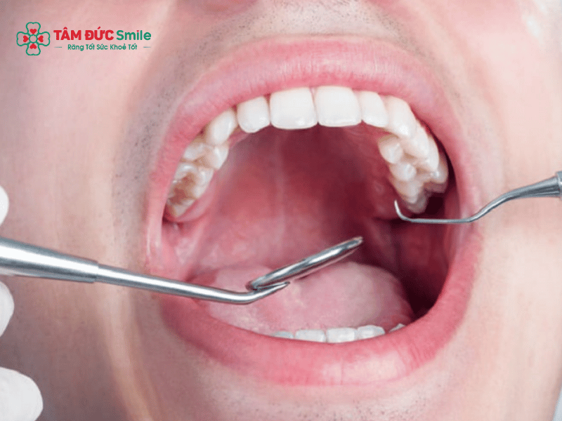 Abc88win đăng nhập khôn hàm trên không đau, an toàn, hồi phục nhanh