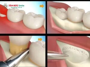 Abc88win đăng nhập khôn xong bị ngứa: Nguyên nhân, cách giảm ngứa, khi nào tái khám