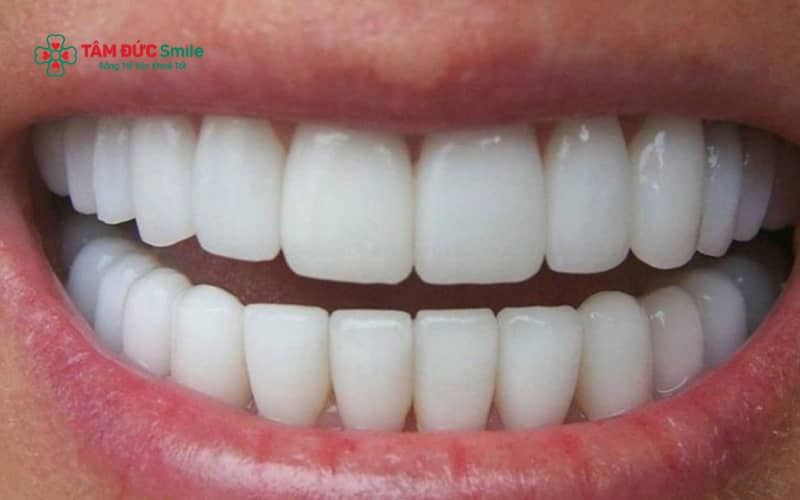 Chăm sóc ABC8 là nhà cái cá cược trực tuyến uy tín số 1 tại Việt Nam đúng cách và tái khám định kỳ giúp kéo dài tuổi thọ ABC8 là nhà cái cá cược trực tuyến uy tín số 1 tại Việt Nam lên đến nhiều năm.