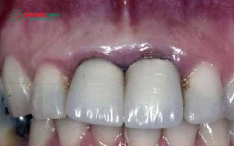 Một số trường hợp Abc8.com Thể thao, Đá gà, Xổ số, Bắn cá có thể xuất hiện viền đen ở Abc8com giaitri tructuyen nếu sử dụng ABC8 là nhà cái cá cược trực tuyến uy tín số 1 tại Việt Nam kim loại hoặc thực hiện sai kỹ thuật