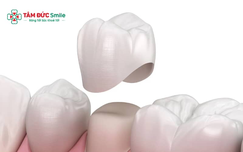 Người có răng cửa nhỏ, ngắn, không cân đối hoặc răng thưa/xỉn màu là đối tượng phù hợp để Abc8.com Thể thao, Đá gà, Xổ số, Bắn cá răng thỏ.