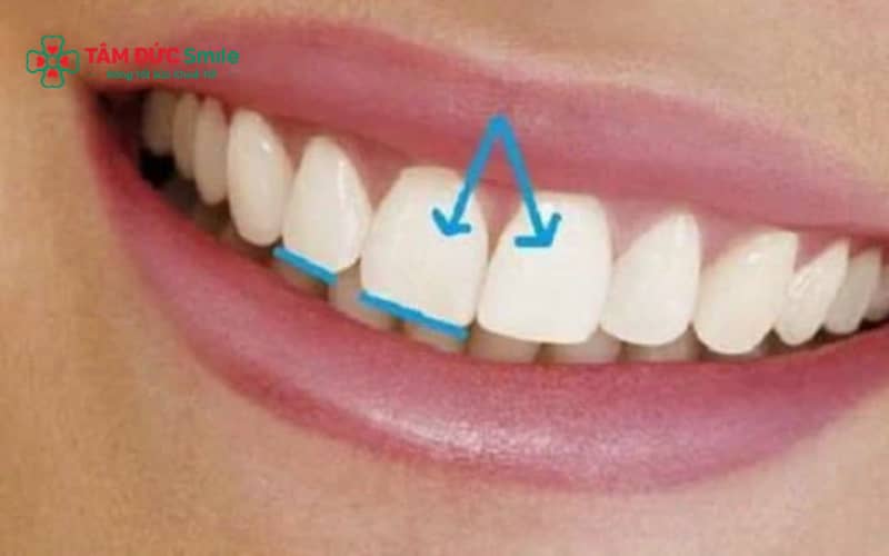 Abc8c1 com được cấp phép bởi PAGCOR Philippines răng thỏ giúp cải thiện hình dáng răng cửa, tạo ABC8 được thành lập vào năm 2011 hoạt động đến hiện tại hài hòa và Abc8c1 com khuyến mãi hấp dẫn hơn