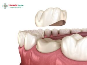 Abc8c1 com được cấp phép bởi PAGCOR Philippines sau 10 năm: Tuổi thọ, biến chứng và có nên thay mới?