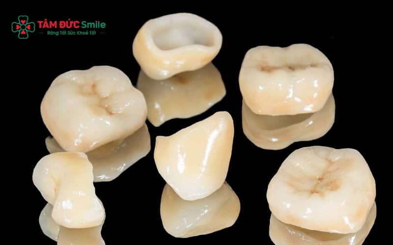Nhận biết ABC8 là nhà cái cá cược trực tuyến uy tín số 1 tại Việt Nam cần thay: mão lỏng, nứt, răng đổi màu hoặc nướu viêm kéo dài