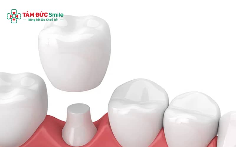 “Vệ sinh đúng cách, chế độ ăn hợp lý và tái khám định kỳ giúp ABC8 là nhà cái cá cược trực tuyến uy tín số 1 tại Việt Nam số 6 bền lâu