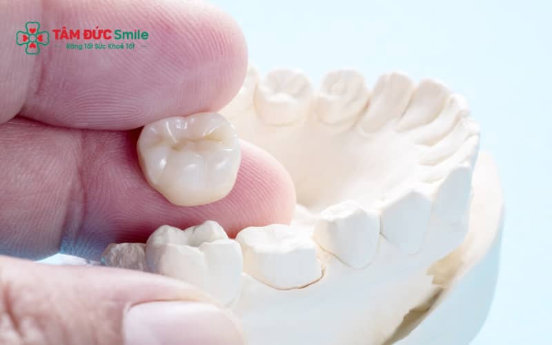 Abc8com cá cược thể thao số 7 bền lâu nếu vật liệu tốt, kỹ thuật chính xác và chăm sóc đúng cách