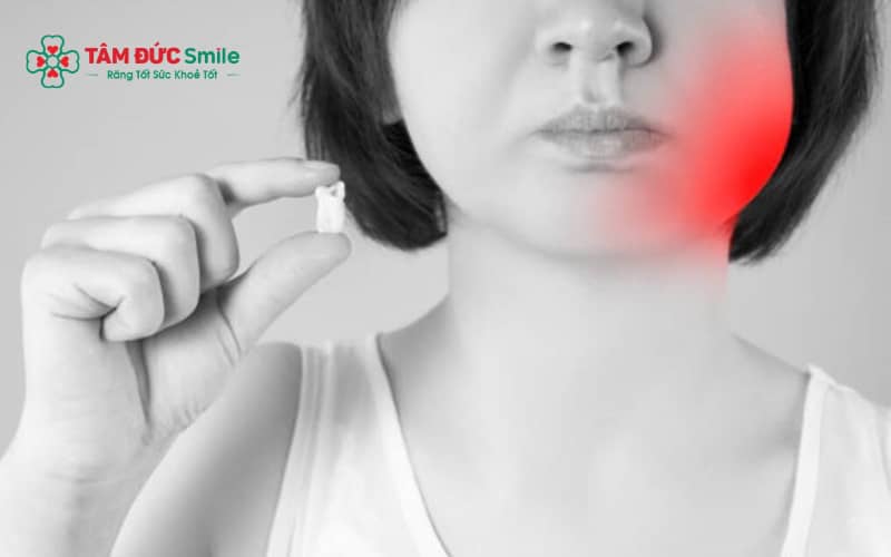 Độ tuổi từ 18–25 được xem là thời điểm phù hợp để nhổ răng khôn do Abc8com giaitri tructuyen chưa phát triển hoàn toàn