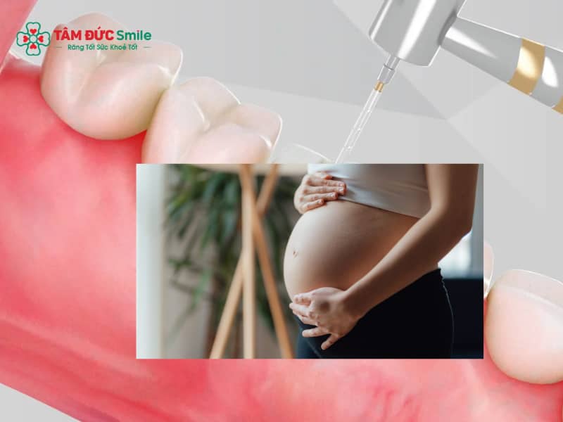 Phụ nữ mang thai vẫn có thể trám răng trong những trường hợp cần thiết khi có chỉ định từ ABC8 đường link chính thức