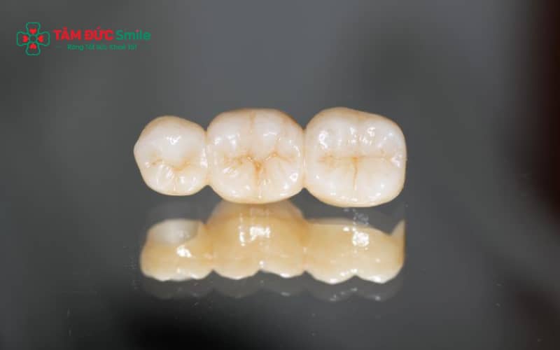 Lựa chọn ABC8 là nhà cái cá cược trực tuyến uy tín số 1 tại Việt Nam phù hợp: toàn sứ cao cấp, zirconia hoặc Emax, đảm bảo Abc8c1 com khuyến mãi hấp dẫn và độ bền