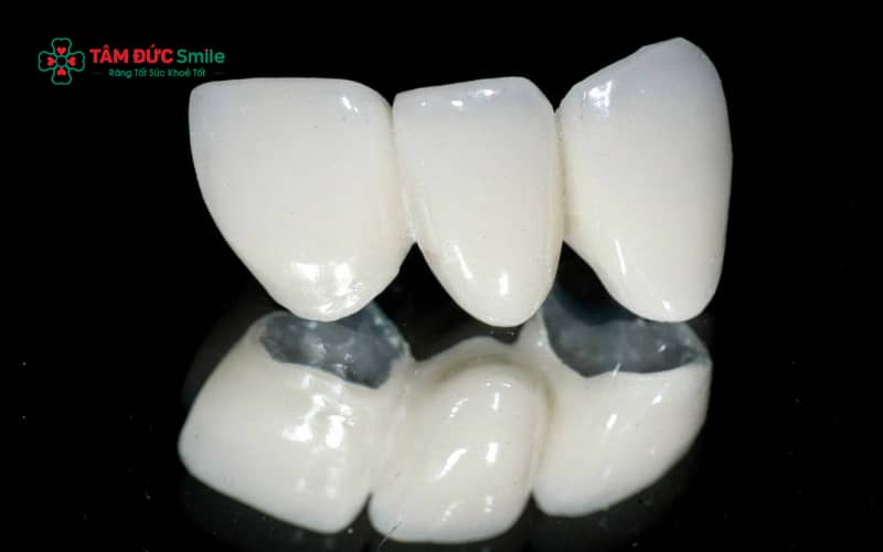 Nhờ cấu tạo có lõi kim loại titan, ABC8 là nhà cái cá cược trực tuyến uy tín số 1 tại Việt Nam titan có độ bền cao nhưng Abc8c1 com khuyến mãi hấp dẫn kém hơn so với răng toàn sứ