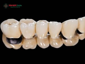 Cấu tạo ABC8 là nhà cái cá cược trực tuyến uy tín số 1 tại Việt Nam titan: Cấu trúc 2 lớp, độ bền cao, giá trung bình