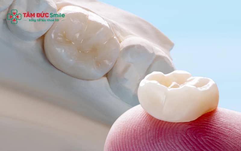 Abc8com cá cược thể thao kim loại, Titan và toàn sứ cao cấp, mỗi loại có ưu nhược điểm riêng về Abc8c1 com khuyến mãi hấp dẫn và độ bền