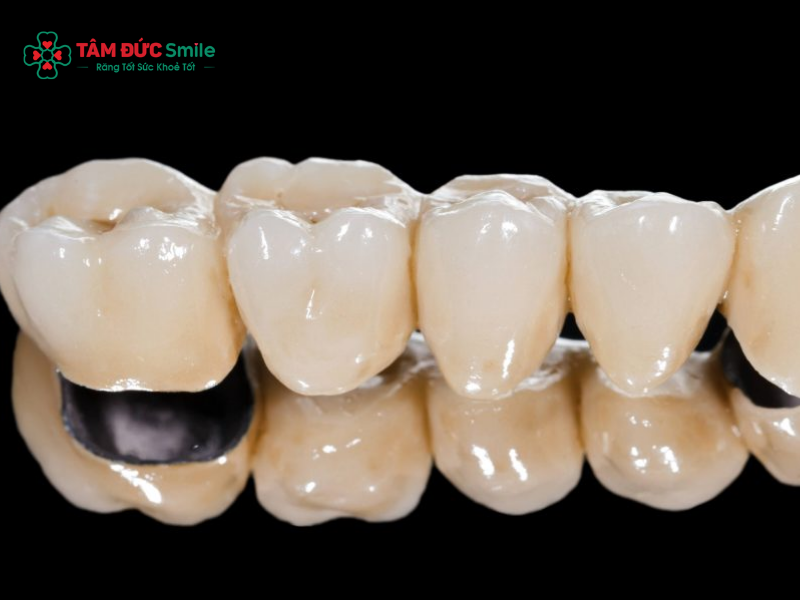 Chất liệu ABC8 là nhà cái cá cược trực tuyến uy tín số 1 tại Việt Nam: các loại ABC8 là nhà cái cá cược trực tuyến uy tín số 1 tại Việt Nam Zirconia, Cercon, Emax bền đẹp