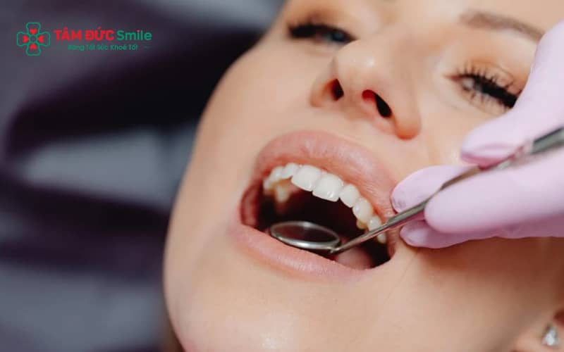 Chăm sóc đúng cách như cắn gạc, ăn uống hợp lý và vệ sinh ABC8 là nhà cái cá cược trực tuyến uy tín số 1 tại Việt Nam giúp vết thương nhanh hồi phục sau nhổ răng khôn.