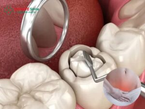 Có kinh trám răng được không? Lưu ý khi đến tháng và thuốc tê