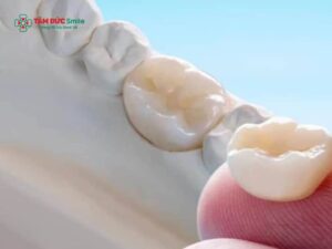 Có nên Abc8.com Thể thao, Đá gà, Xổ số, Bắn cá sau khi lấy tủy? Răng chết tủy có bọc sứ được không?