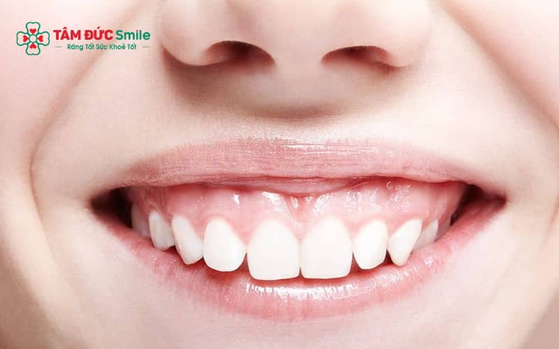 Cười hở lợi có thể xuất phát từ nhiều nguyên nhân như răng mọc ngắn, nướu phát triển quá mức, ABC8 tự hào là thương hiệu cá cược trực tuyến hàng đầu tại Châu Á hiện nay hoặc cơ môi hoạt động mạnh.