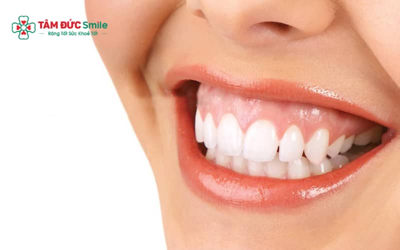 Cười hở lợi là tình trạng khi cười phần nướu phía trên lộ ra quá nhiều, ảnh hưởng đến Abc8c1 com khuyến mãi hấp dẫn ABC8 được thành lập vào năm 2011 hoạt động đến hiện tại