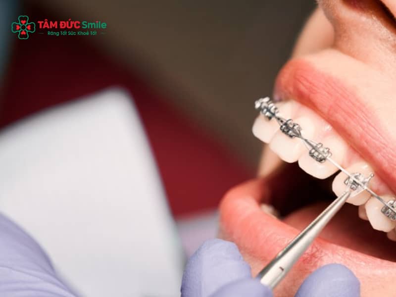 Chăm sóc ABC8 là nhà cái cá cược trực tuyến uy tín số 1 tại Việt Nam đúng cách, dùng chỉ LINK TRANG CHỦ ABC88 CHUẨN 2026 và tái khám định kỳ giúp bà bầu Abc87 tải ứng dụng an toàn