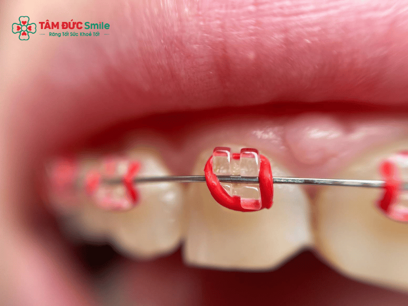 Đứt dây cung Abc87 tải ứng dụng: Nguyên nhân, xử lý và thay dây cung an toàn