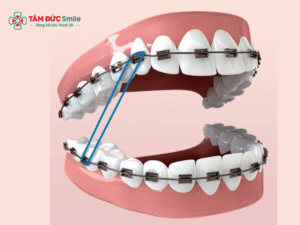 Hối hận khi Abc87 tải ứng dụng? Tác hại, chi phí và kinh nghiệm Abc87 tải ứng dụng đúng cách?