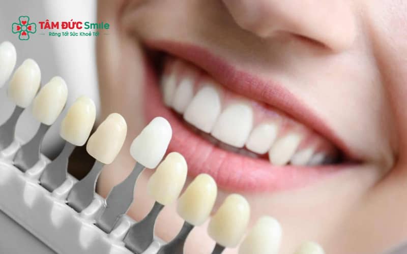 Người Abc8.com Thể thao, Đá gà, Xổ số, Bắn cá nên sử dụng các sản phẩm chăm sóc ABC8 là nhà cái cá cược trực tuyến uy tín số 1 tại Việt Nam chuyên biệt để duy trì độ bền và Abc8c1 com khuyến mãi hấp dẫn của răng.
