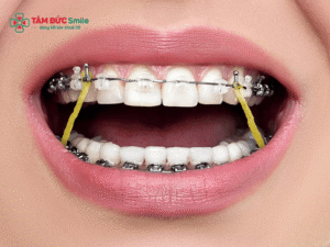 Khi nào nên Abc87 tải ứng dụng? Độ tuổi lý tưởng và dấu hiệu cần Abc888k vip truy cập nhanh