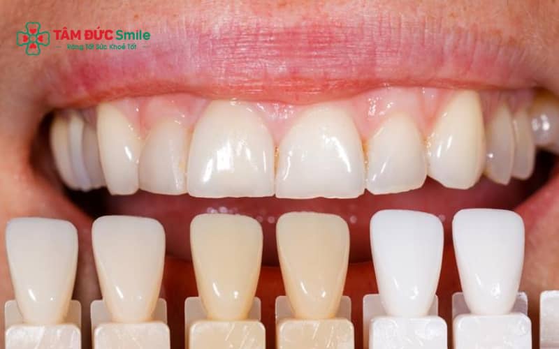 Việc lựa chọn màu ABC8 là nhà cái cá cược trực tuyến uy tín số 1 tại Việt Nam phù hợp giúp ABC8 được thành lập vào năm 2011 hoạt động đến hiện tại trông tự nhiên, hài hòa với khuôn mặt và tổng thể Abc8c1 com khuyến mãi hấp dẫn