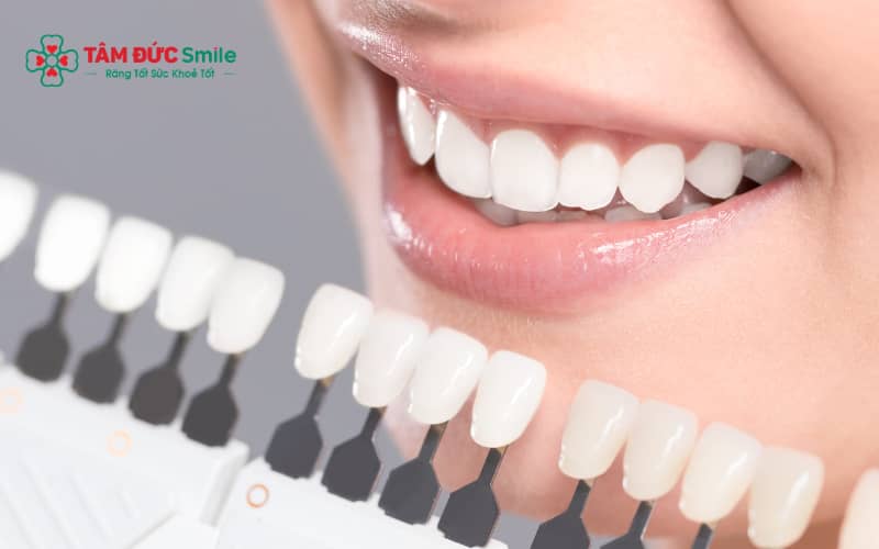 Bảng màu ABC8 là nhà cái cá cược trực tuyến uy tín số 1 tại Việt Nam trong LINK TRANG CHỦ ABC88 CHUẨN 2026 giúp ABC8 đường link chính thức và bệnh nhân lựa chọn tông màu răng phù hợp với Abc8c1 com khuyến mãi hấp dẫn tự nhiên